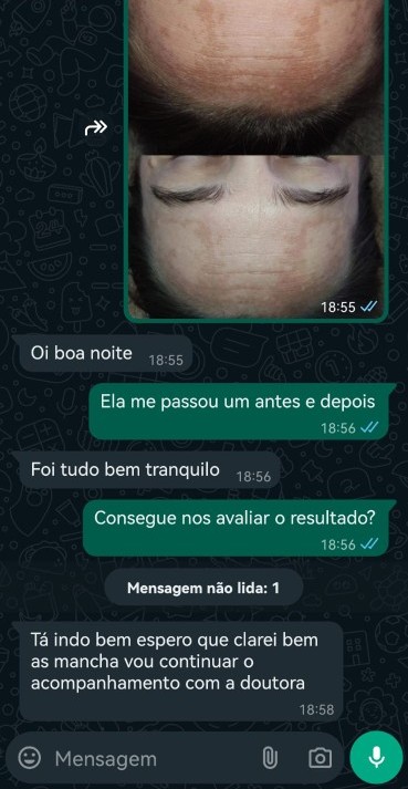 Depoimento cliente – Resultado manchas