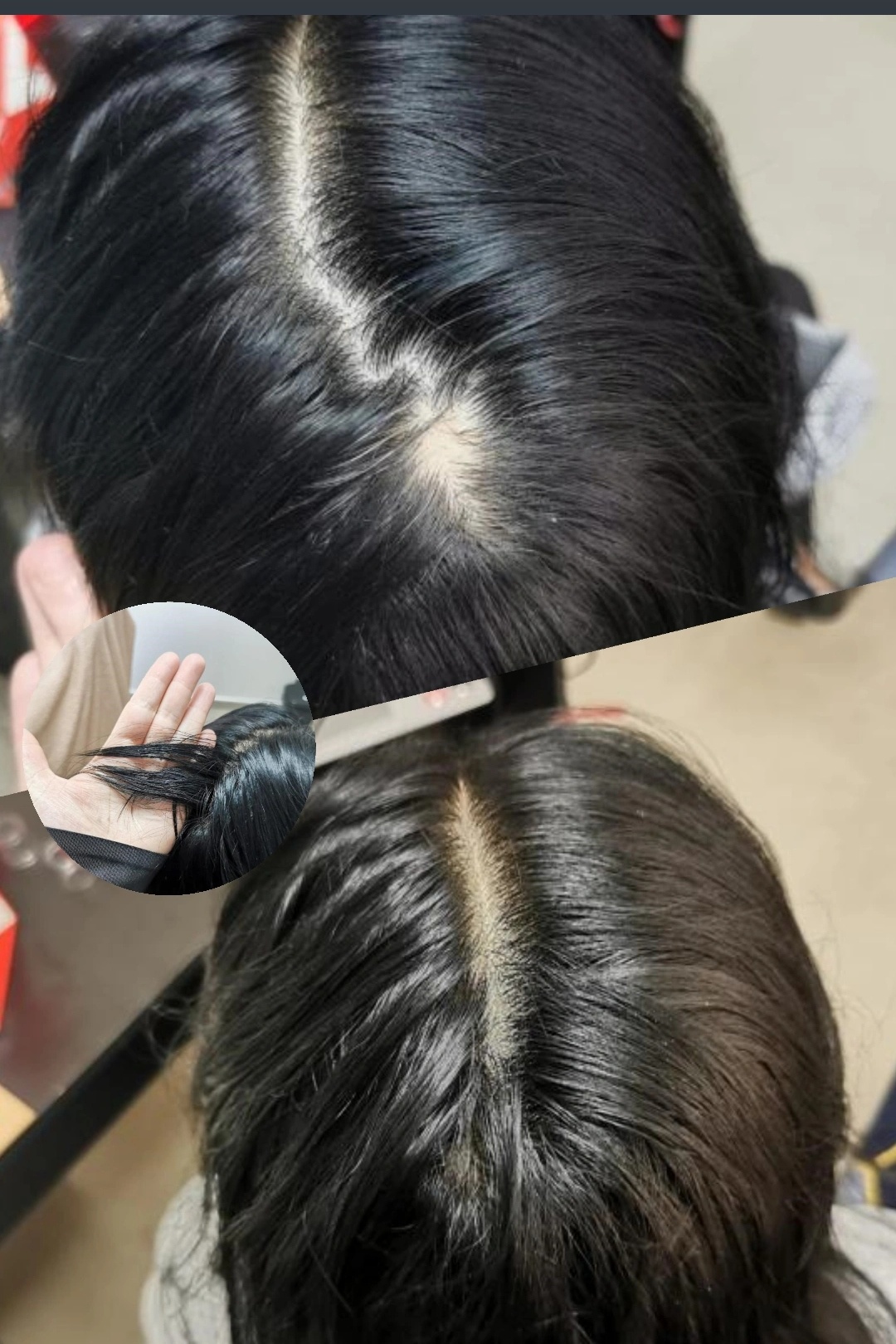 Resultado Capilar – Antes e Depois 3